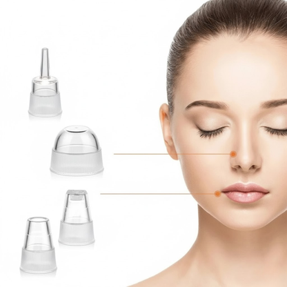 Extracteur De Points Noirs Avec Succion Réglable Pour Nettoyage Profond Et Peau Radieuse Blackhead extractor Electro Paris