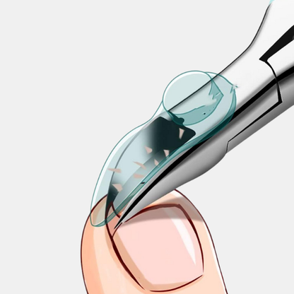 Coupe-Ongles Confort – Précision et Sécurité pour Seniors New3 Electro Paris